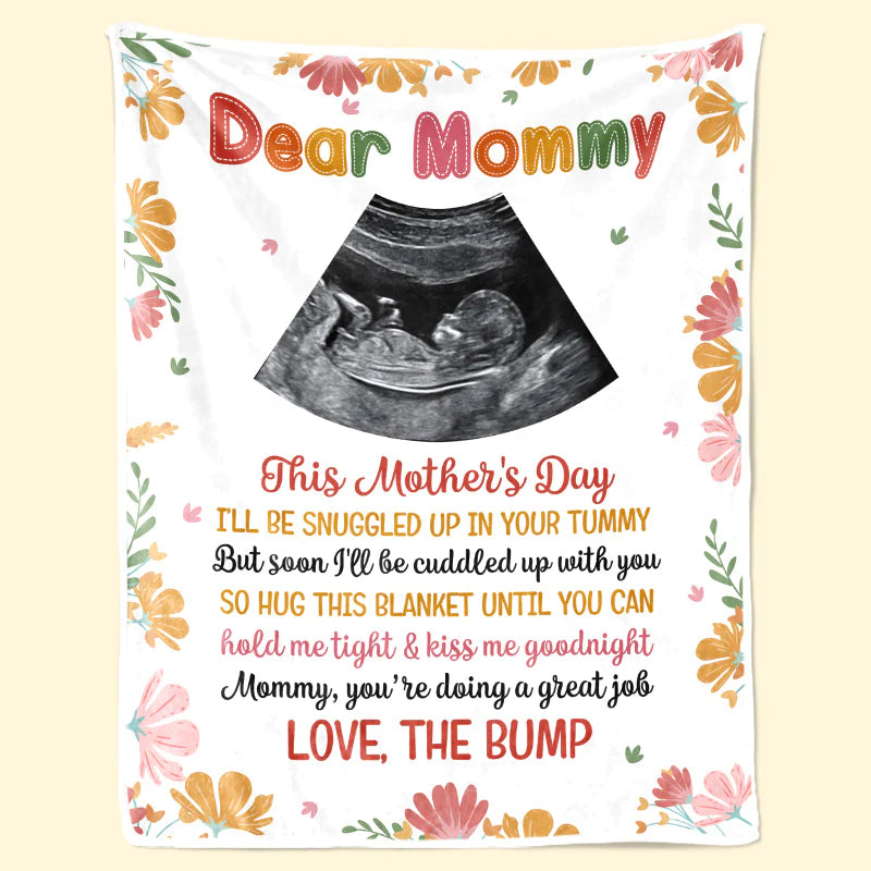 First Mom Blanket - Baby B-ultrasound Photo Blanket,Personalized Custom Baby Blanket