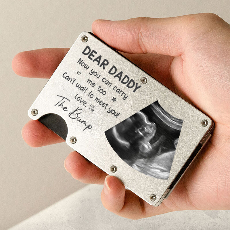 Personalized Metal Card Holder Custom Baby Photo Warm Father's Day Gift