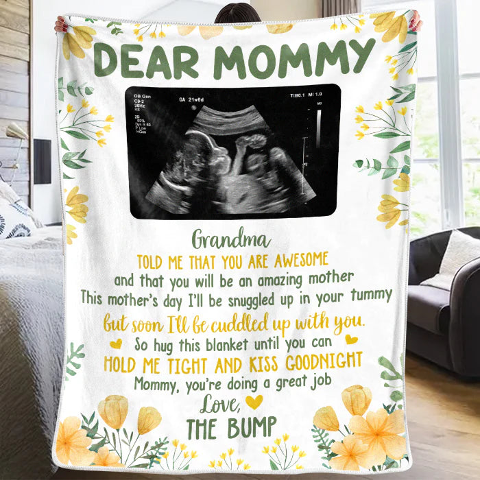 Baby B-ultrasound Photo Blanket, First Mom Gift ,Personalized Custom Baby Blanket
