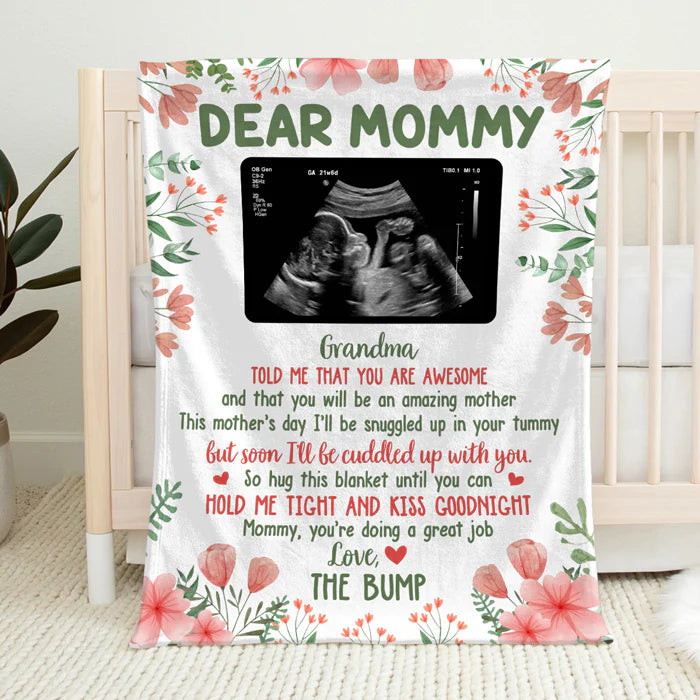 Baby B-ultrasound Photo Blanket, First Mom Gift ,Personalized Custom Baby Blanket