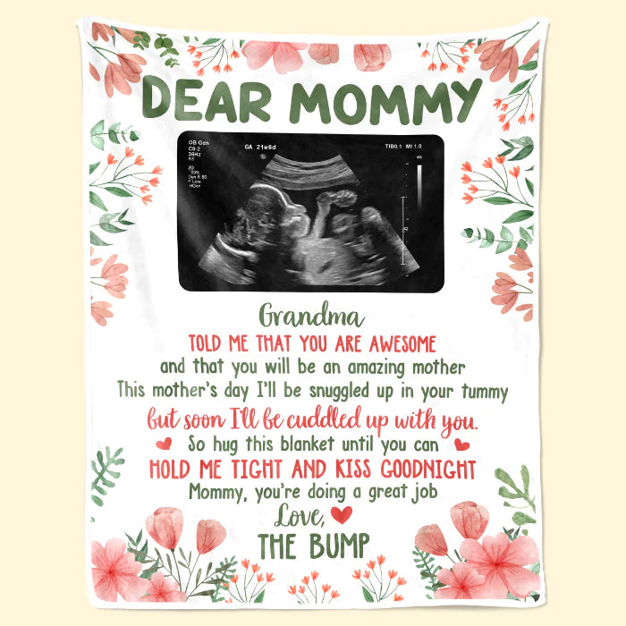 Baby B-ultrasound Photo Blanket, First Mom Gift ,Personalized Custom Baby Blanket