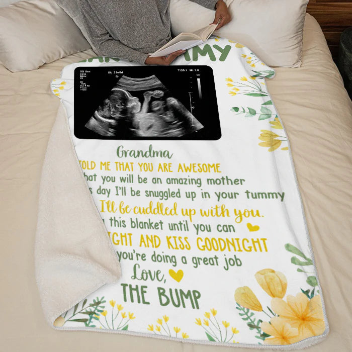 Baby B-ultrasound Photo Blanket, First Mom Gift ,Personalized Custom Baby Blanket